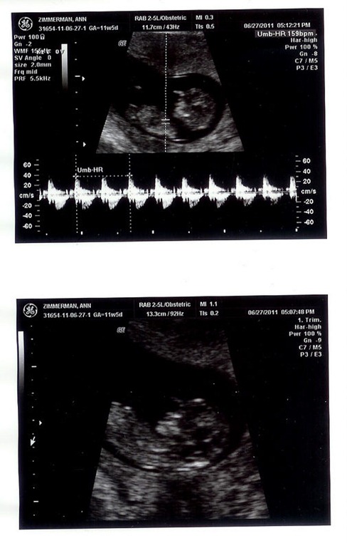 Sono---12-weeks